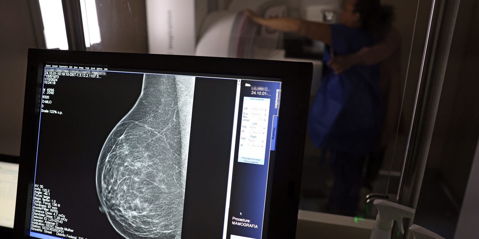 Câncer de mama: mulheres em tratamento têm direito a auxílio e aposentadoria por incapacidade