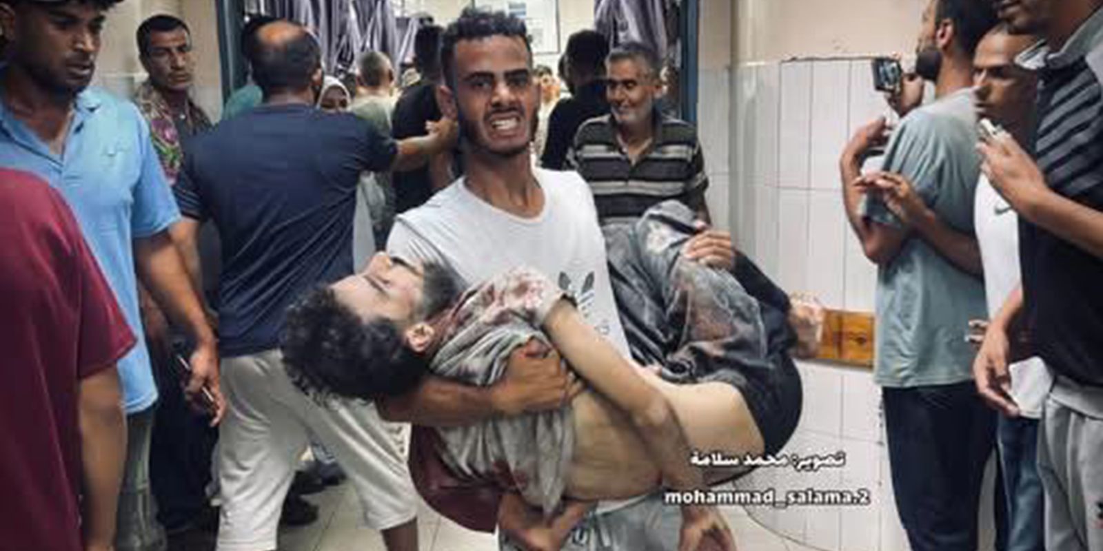 Mortes por fome e ataques em Gaza aumentam e ONU alerta para “cadáveres ambulantes”